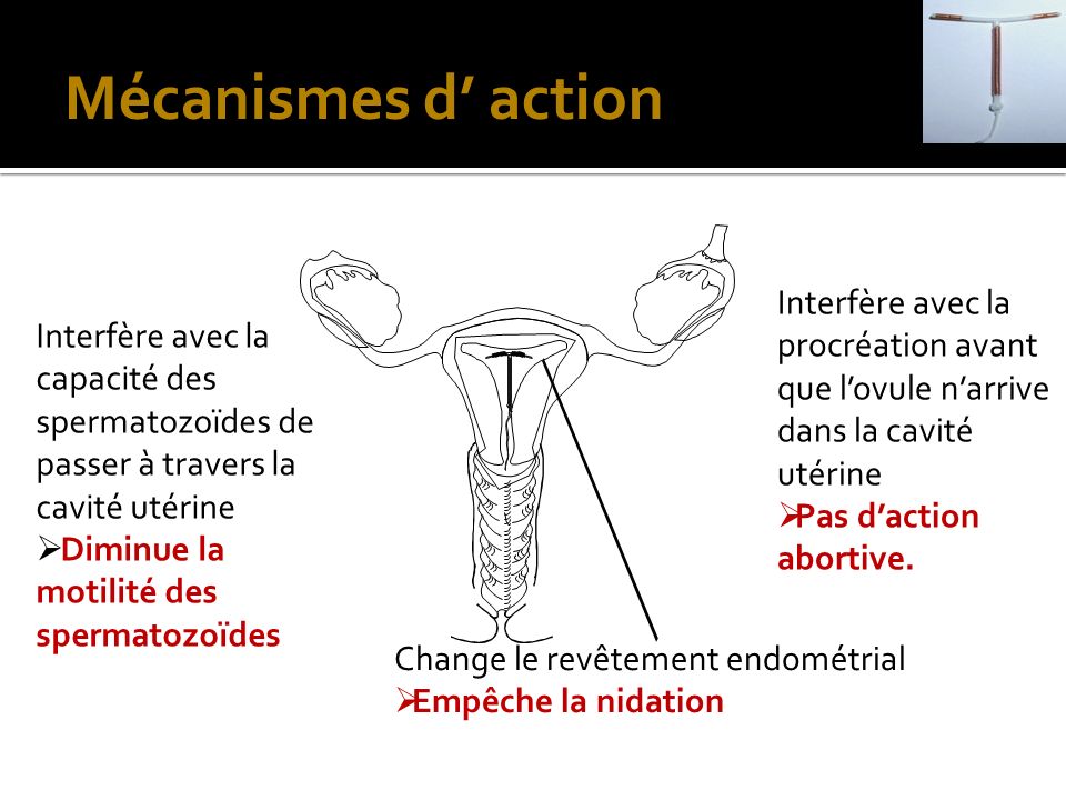Mécanismes d’ action Interfère avec la procréation avant que l’ovule n’arrive dans la cavité utérine.