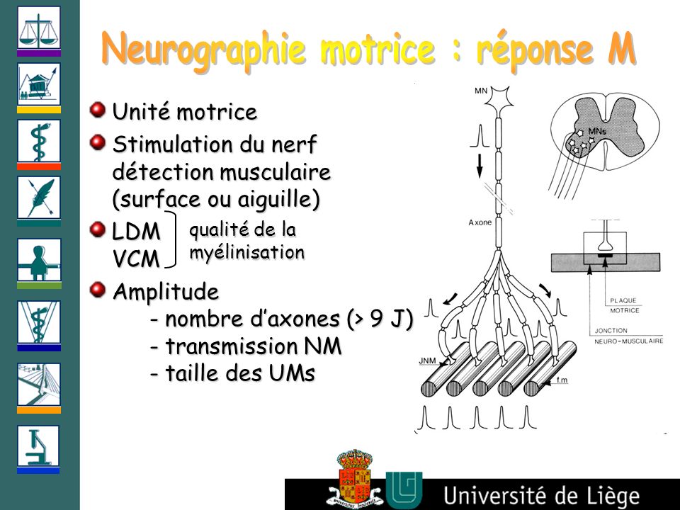 Neurographie motrice : réponse M
