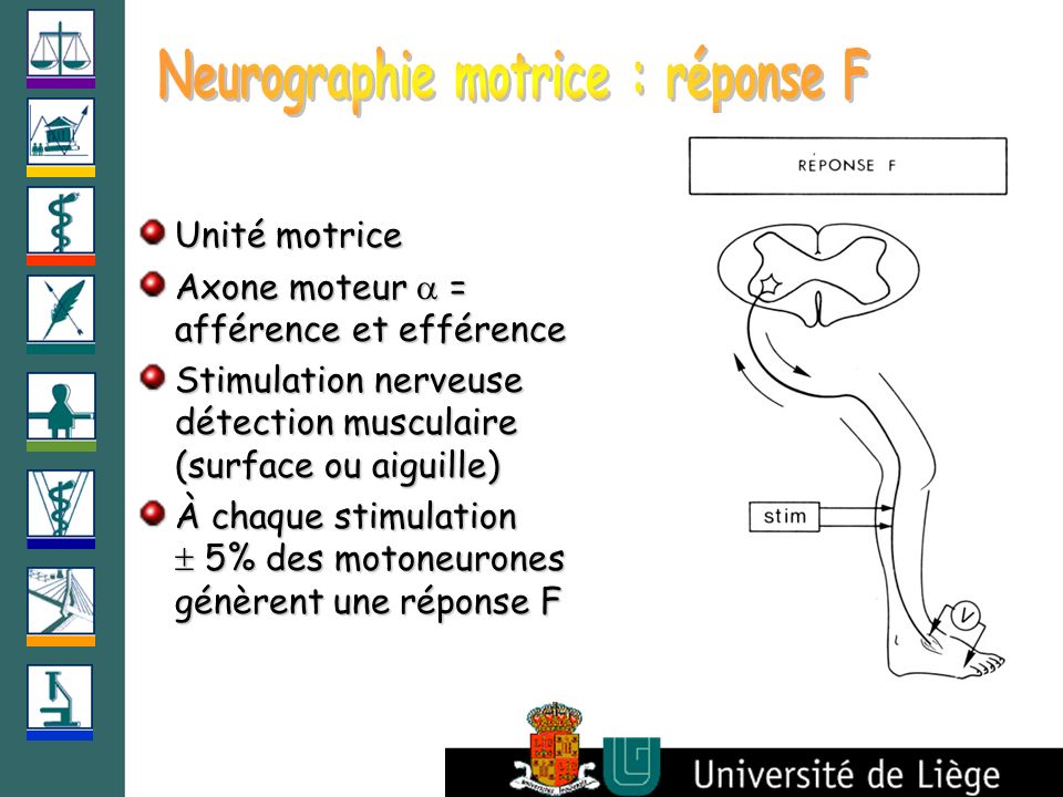 Neurographie motrice : réponse F