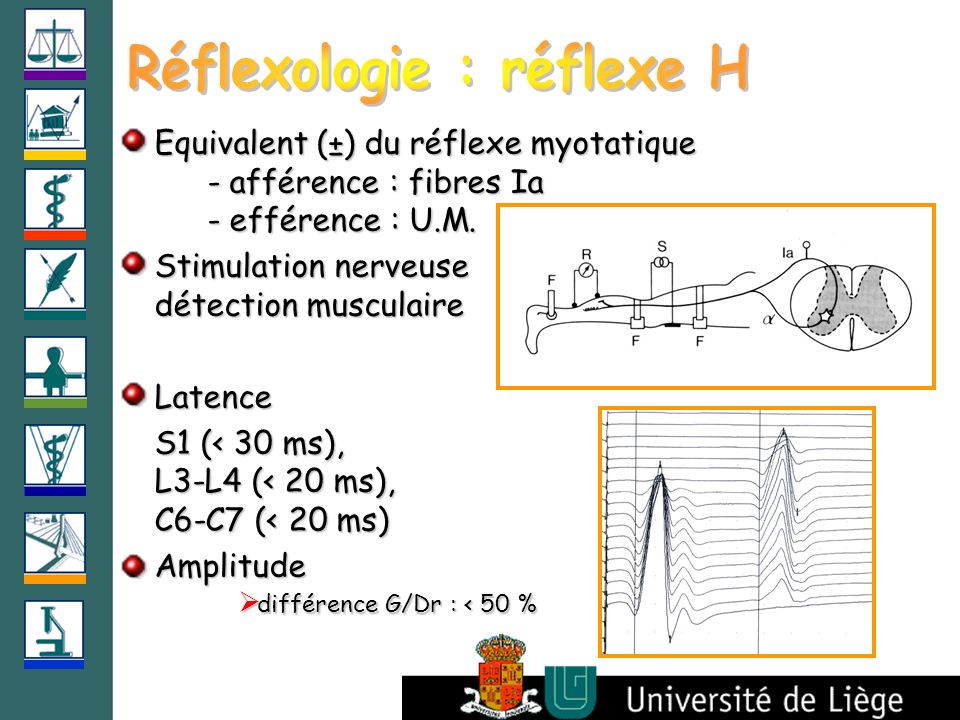 Réflexologie : réflexe H