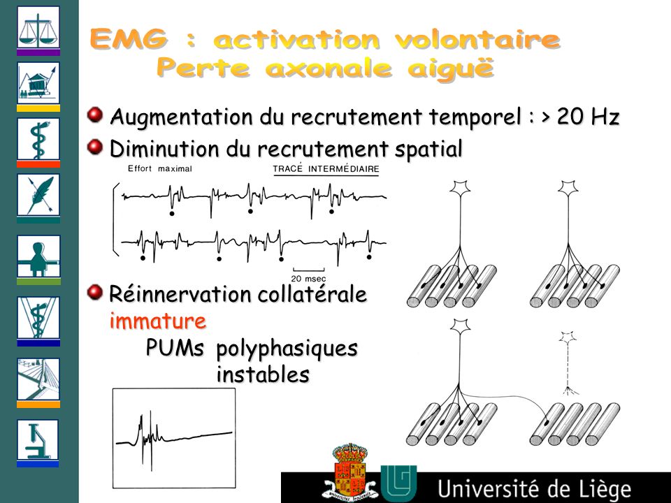 EMG : activation volontaire