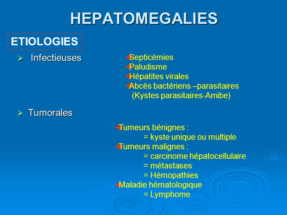 HEPATOMEGALIES ETIOLOGIES Infectieuses Tumorales Septicémies Paludisme